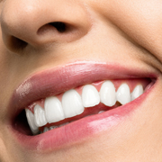 5 Things to Avoid After Teeth Whitening | Milltown | Newark