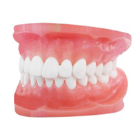 Dentures