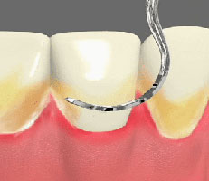 Periodontics